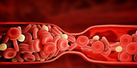 signs-have-blood-clot-main-2-1515711356.