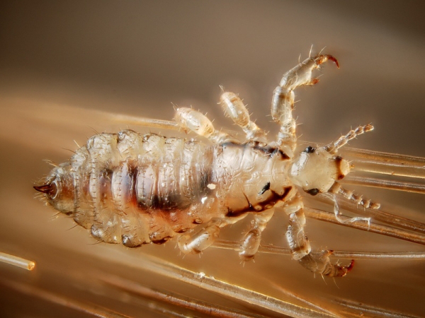 head-lice.jpg?w=740