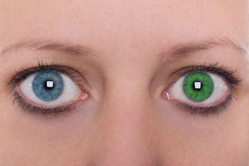 Bildergebnis für iris heterochromie blau grün