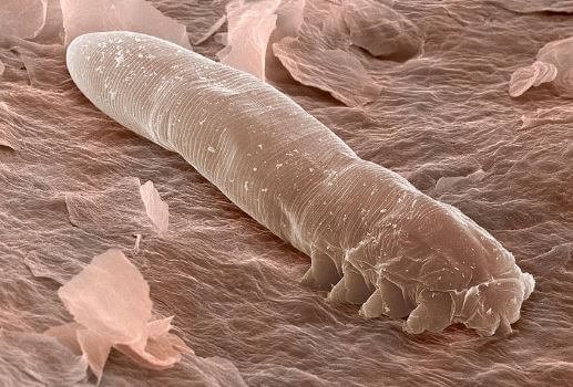 Image result for demodex