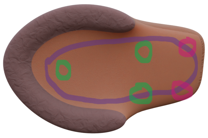 A horse-like hoof, showing the underside with markers. One purple surrounding the inside and upwards the backside. A green one at the inside tip and two right at the beginning of the backside. Two more pink ones on the backside up.